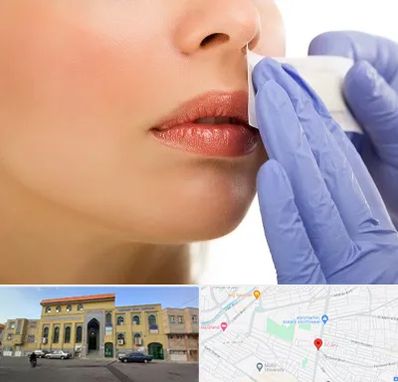 اپیلاسیون صورت در زنبیل آباد قم