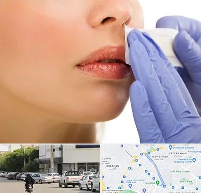 اپیلاسیون صورت در قدوسی شرقی شیراز