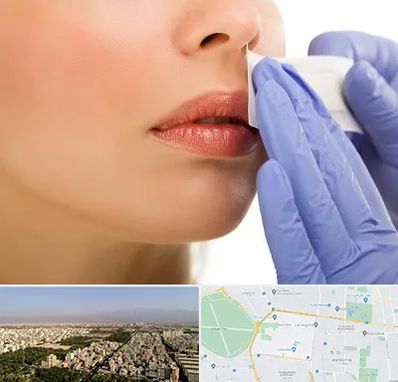 اپیلاسیون صورت در نازی آباد