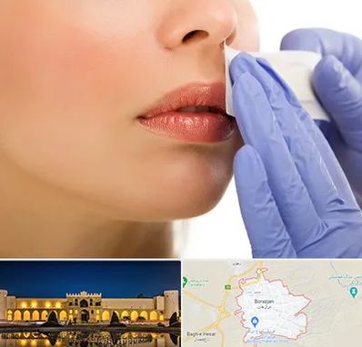 اپیلاسیون صورت در برازجان