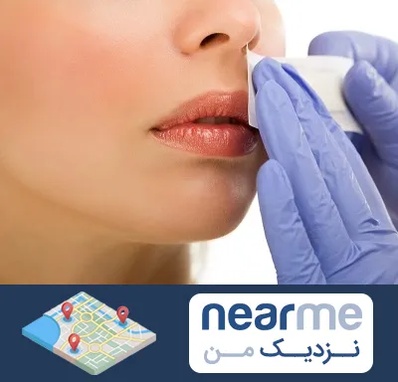 اپیلاسیون صورت در نزدیک من