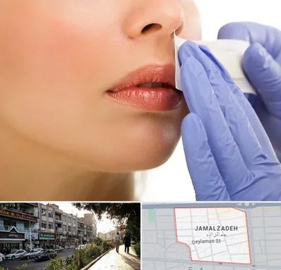 اپیلاسیون صورت در خیابان جمالزاده