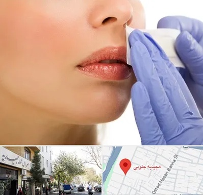 اپیلاسیون صورت در مجیدیه جنوبی