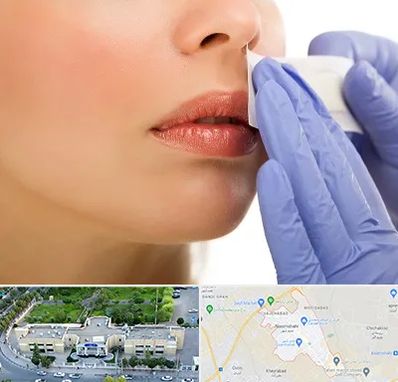 اپیلاسیون صورت در نسیم شهر