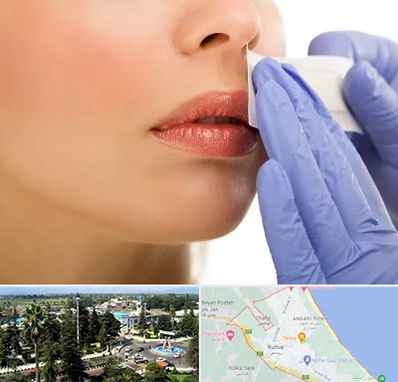 اپیلاسیون صورت در رودسر