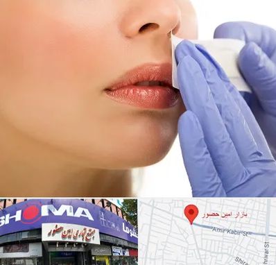 اپیلاسیون صورت در امین حضور