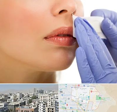 اپیلاسیون صورت در منطقه 14 تهران 