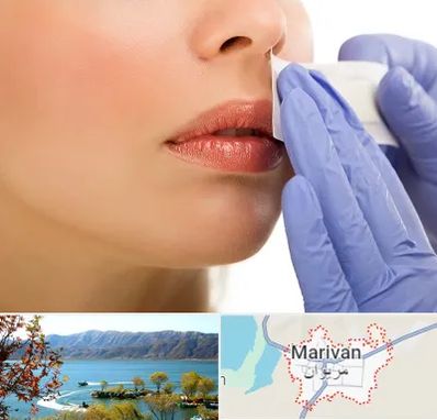 اپیلاسیون صورت در مریوان