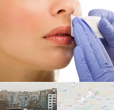 اپیلاسیون صورت در محمد شهر کرج