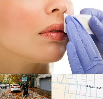 اپیلاسیون صورت در خیابان فلسطین