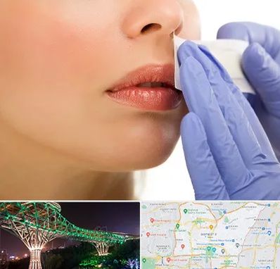 اپیلاسیون صورت در منطقه 3 تهران 