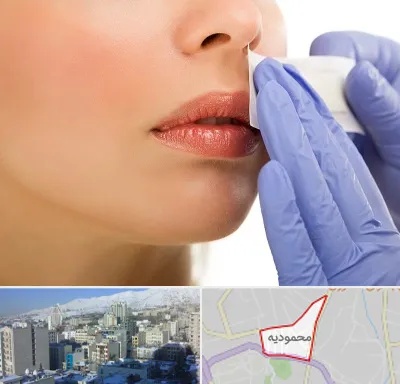 اپیلاسیون صورت در محمودیه