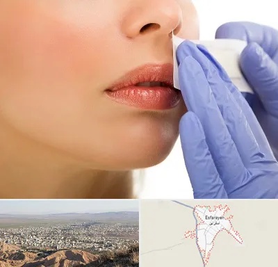 اپیلاسیون صورت در اسفراین