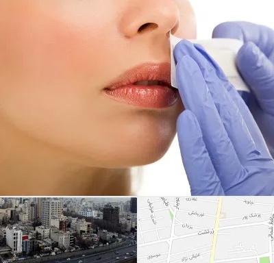 اپیلاسیون صورت در زرتشت