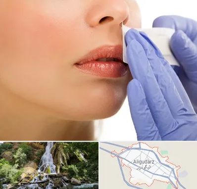 اپیلاسیون صورت در الیگودرز