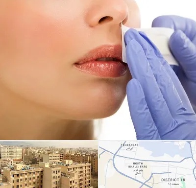 اپیلاسیون صورت در جنوب غرب تهران