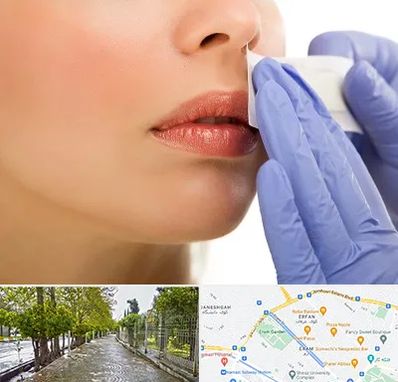 اپیلاسیون صورت در خیابان ارم شیراز