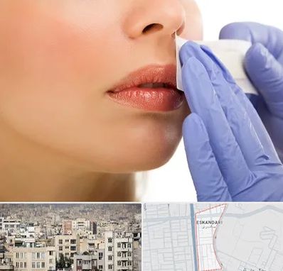 اپیلاسیون صورت در اسکندری