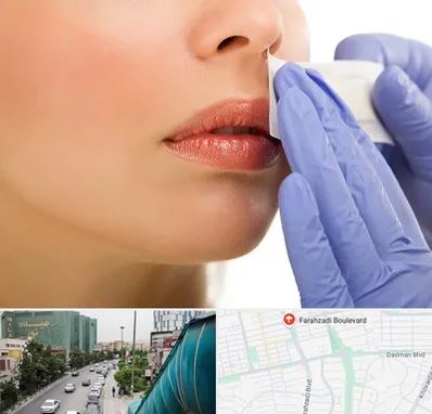 اپیلاسیون صورت در بلوار فرحزادی