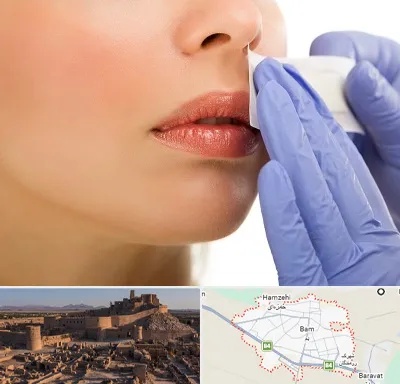 اپیلاسیون صورت در بم