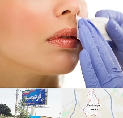 اپیلاسیون صورت در فردوسیه شهریار