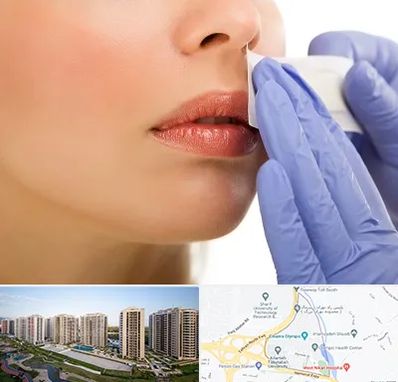 اپیلاسیون صورت در المپیک 