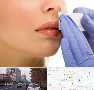 اپیلاسیون صورت در کارگر شمالی 