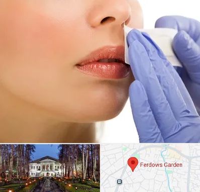 اپیلاسیون صورت در باغ فردوس