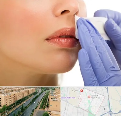 اپیلاسیون صورت در فاز سه اندیشه