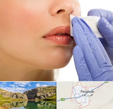 اپیلاسیون صورت در فیروزکوه