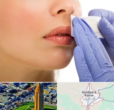 اپیلاسیون صورت در گنبد کاووس