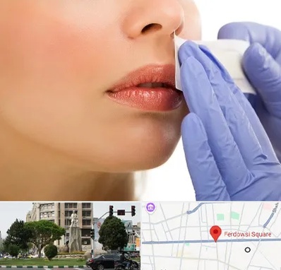 اپیلاسیون صورت در میدان فردوسی تهران