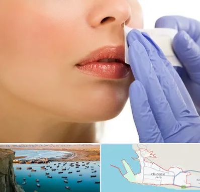 اپیلاسیون صورت در چابهار