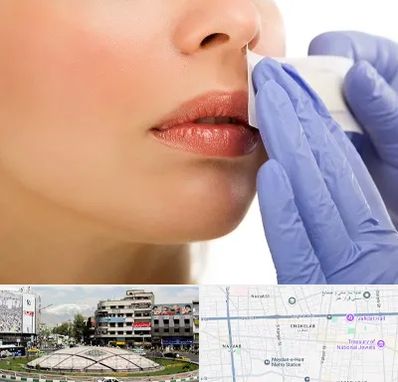 اپیلاسیون صورت در مرکز تهران