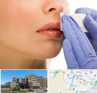 اپیلاسیون صورت در صیاد شیرازی مشهد