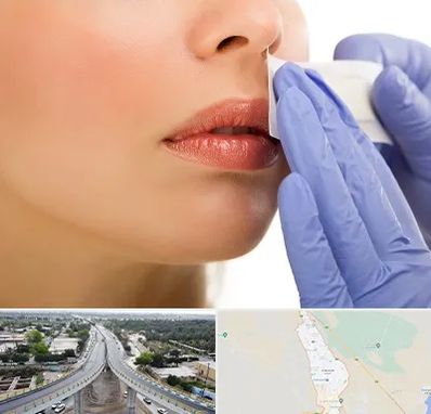 اپیلاسیون صورت در اندیمشک