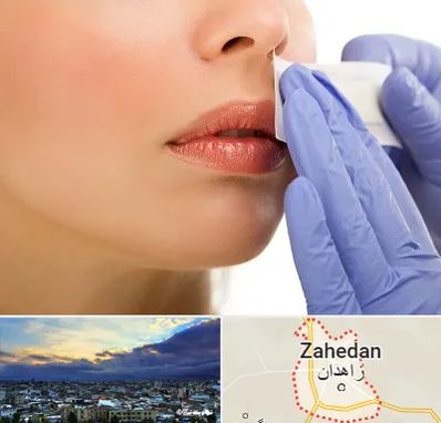 اپیلاسیون صورت در زاهدان