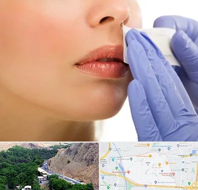 اپیلاسیون صورت در کن 