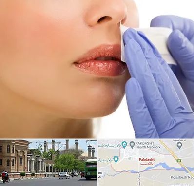 اپیلاسیون صورت در پاکدشت