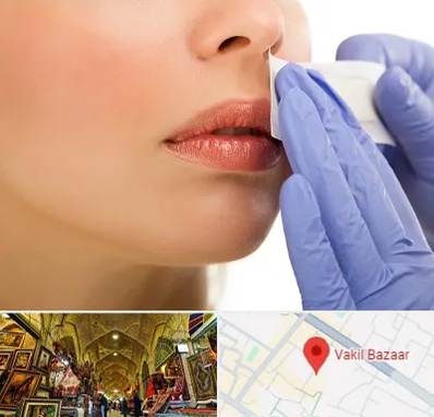 اپیلاسیون صورت در بازار وکیل شیراز