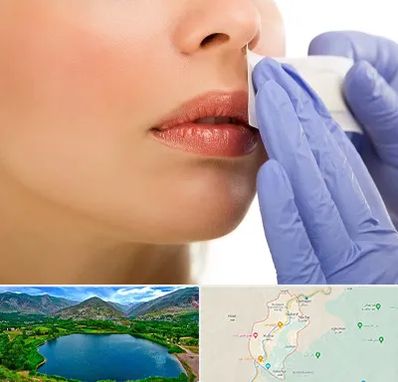 اپیلاسیون صورت در رودبار