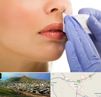 اپیلاسیون صورت در بیجار