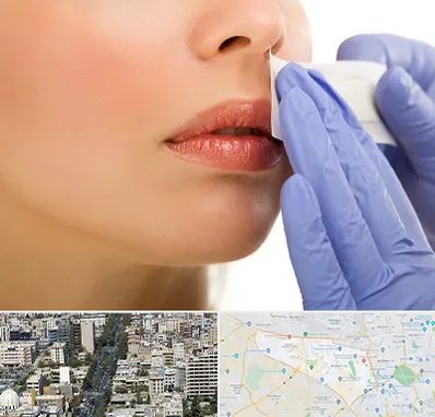 اپیلاسیون صورت در منطقه 18 تهران 