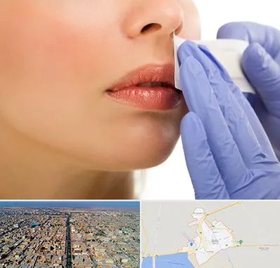 اپیلاسیون صورت در بندر ماهشهر