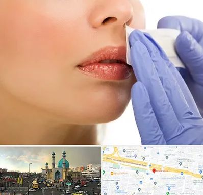 اپیلاسیون صورت در رسالت 