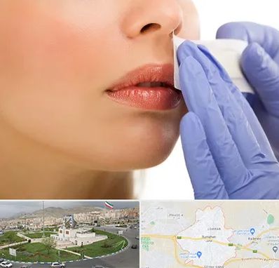 اپیلاسیون صورت در بومهن