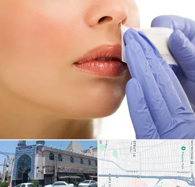 اپیلاسیون صورت در بلوار ابوذر
