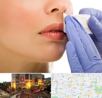 اپیلاسیون صورت در جنت آباد تهران 