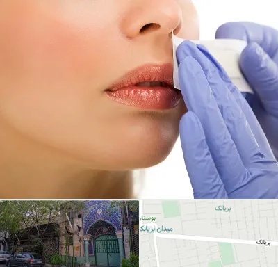 اپیلاسیون صورت در بریانک