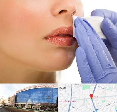 اپیلاسیون صورت در نصف راه تبریز